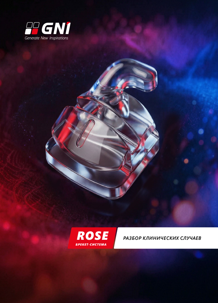 Клинические случаи Rose